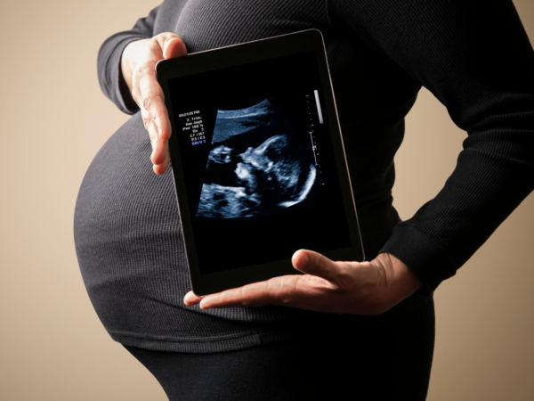 The Future of Ultrasound Technology: Your Baby’s First Steps in the Digital World