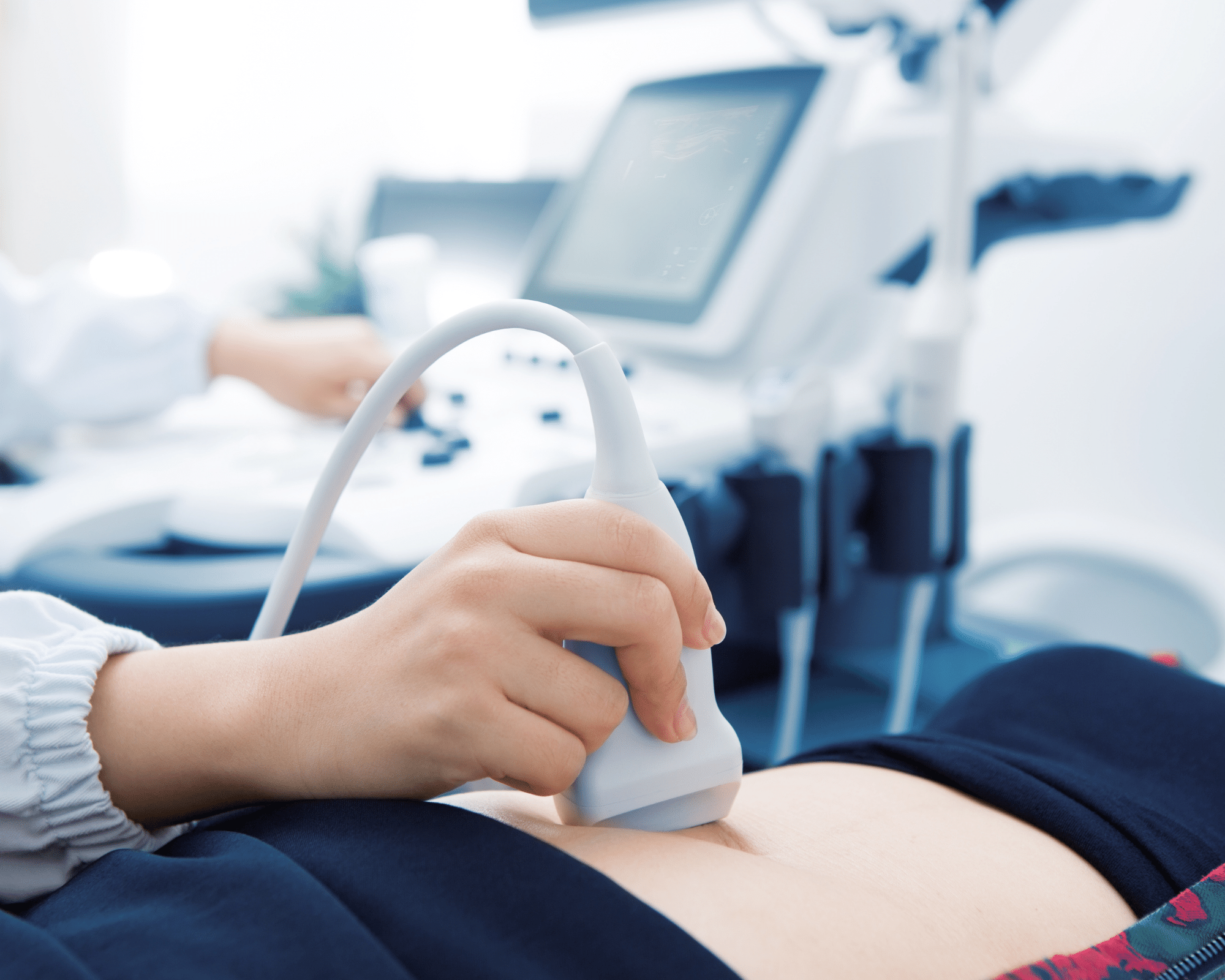 How Long Does an Ultrasound Take?