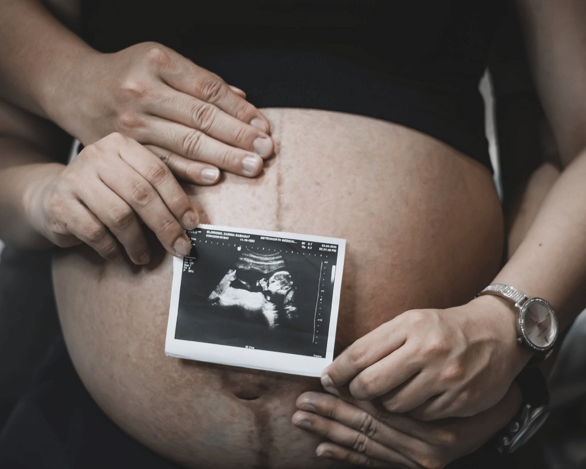 The Importance and Stages of Ultrasound Imaging During Pregnancy